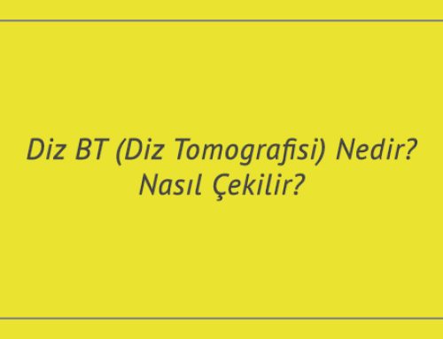 Diz BT (Diz Tomografisi) Nedir? Nasıl Çekilir? Fiyatları Ne Kadar?