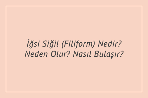 İğsi Siğil (Filiform) Nedir? Neden Olur? Nasıl Bulaşır?